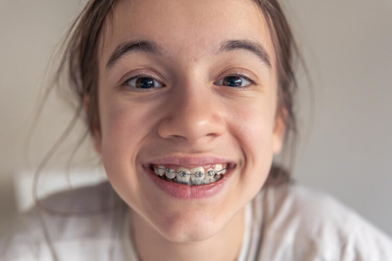 appareil dentaire enfant